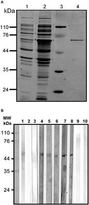 Entamoeba histolytica Calreticulin Induces the Expression of Cytokines in Peripheral Blood Mononuclear Cells Isolated From Patients With Amebic Liver Abscess